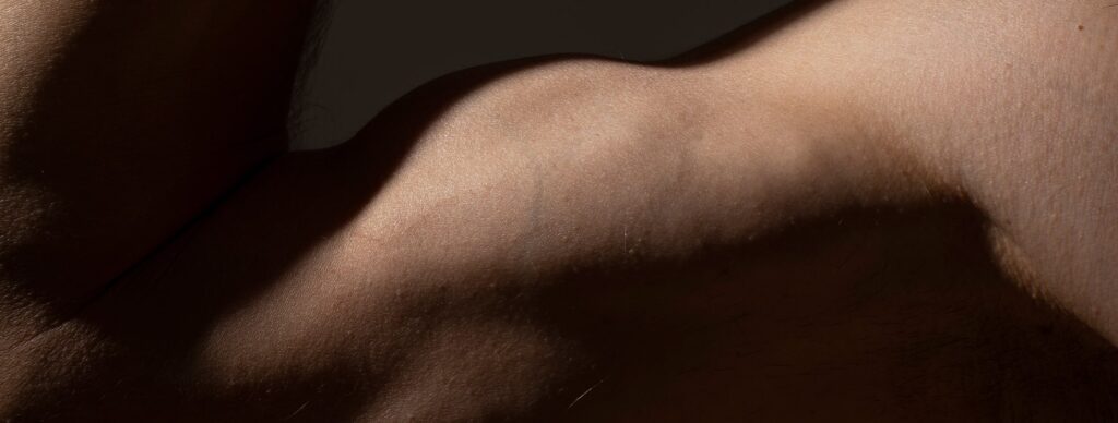 tendon rupture biceps distal operation convalescence dr pierre laumonerie chirurgien specialiste du coude paris